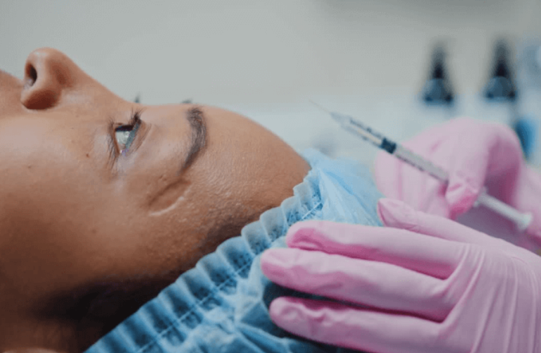 Dermal Fillers in Lucknow